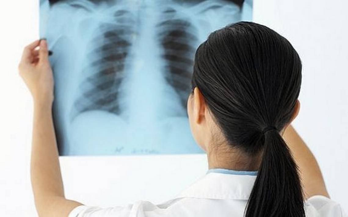 Những điều bạn cần biết về căn bệnh lao màng phổi